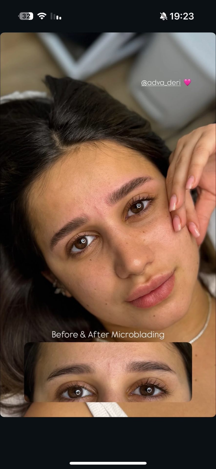 Before & After Microblading